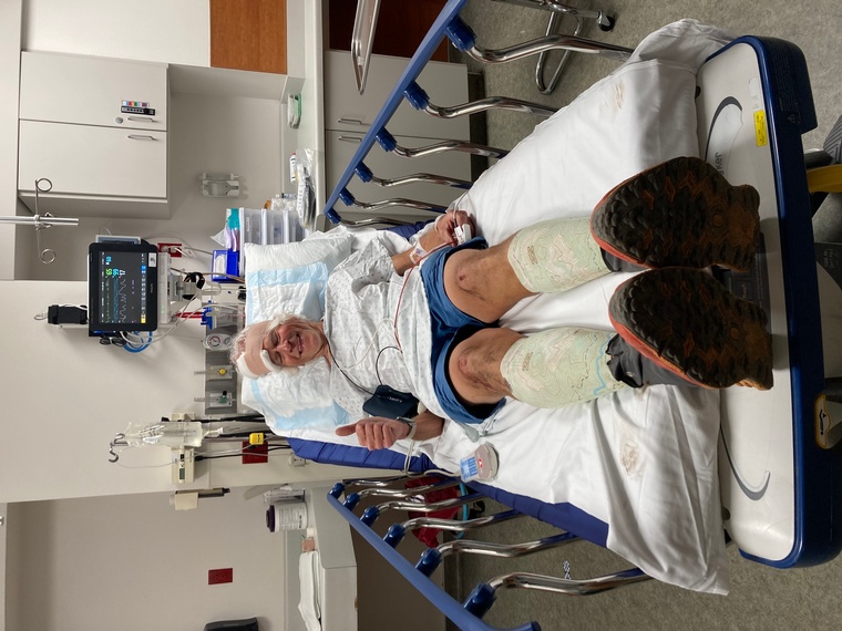 click to enlarge - photo by: Bear 100 Runner Support - Huge THANK YOU to the ‘sweeps’ that found Tim & the medical crew that got him back to Tony Grove safely & on his way to Logan Regional. Stitches in the noggin & good as new. #18 will have to wait until next year.